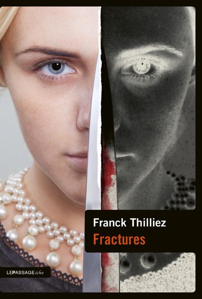 FRACTURES