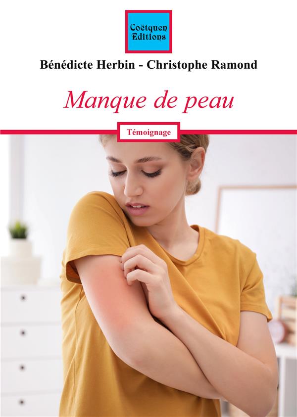 MANQUE DE PEAU