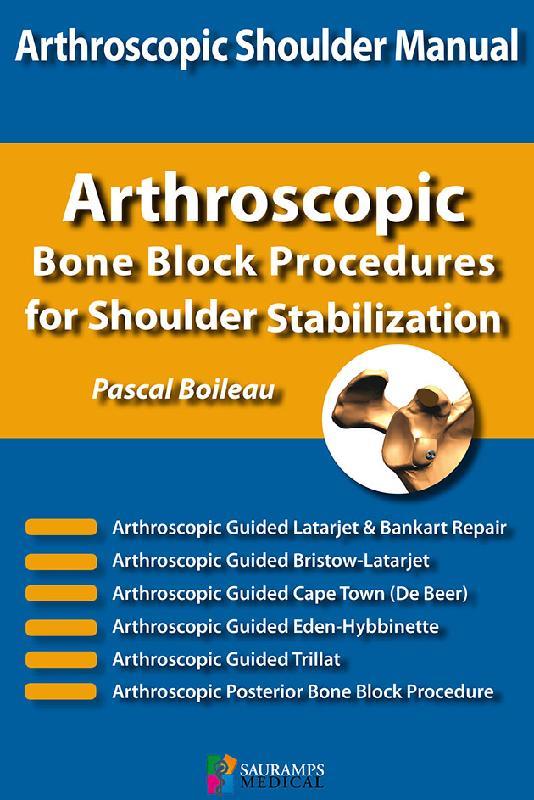 SHOULDER CONCEPTS BON BLOCK PROCEDURES FOR SHOULDER STABILIZATION