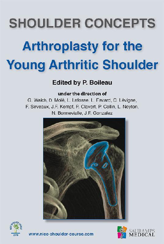 SHOULDER CONCEPTS ARTHROPLASTY FOR THE YOUNG ARTHRITIC SHOULDER