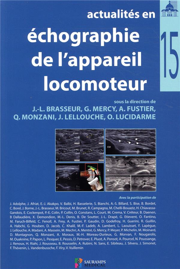 ACTUALITES EN ECHOGRAPHIE DE L APPAREIL LOCOMOTEUR T 15