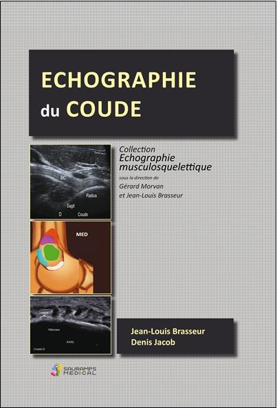 ECHOGRAPHIE DU COUDE