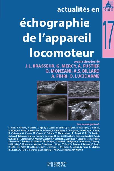 ACTUALITES EN ECHOGRAPHIE DE L APPAREIL LOCOMOTEUR T 17