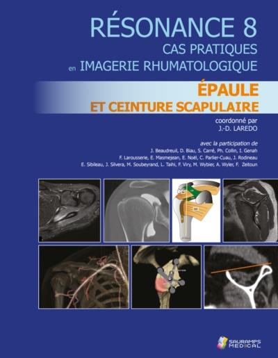 RESONANCE 8 - EPAULE ET CEINTURE SCRAPULAIRE - CA PRATIQUE IMAGERIE RHUMATOLOGIQUE