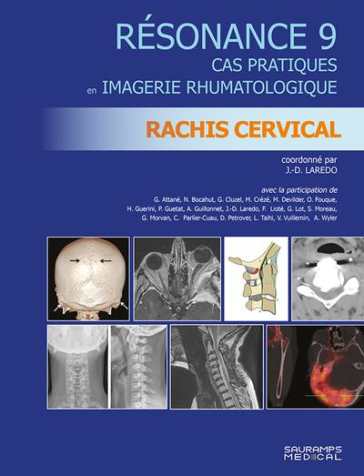 RESONANCE 9. RACHIS CERVICAL - CAS PRATIQUES EN IMAGERIE RHUMATOLOGIQUE