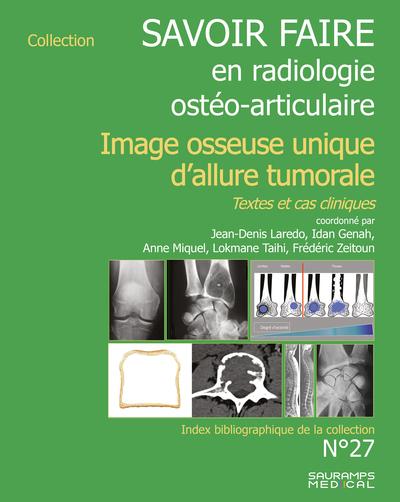 SAVOIR FAIRE EN IMAGERIE OSTEO ARTICULAIRE N 27 - IMAGERIE OSSEUSE UNIQUE D'ALLURE TUMORALE