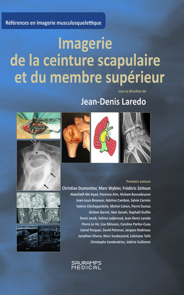 IMAGERIE DE LA CEINTURE SCRAPULAIRE ET DU MEMBRE SUPERIEUR