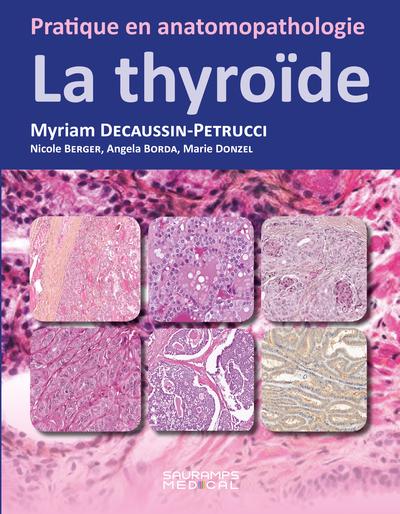 LA THYROIDE - PRATIQUE EN ANATOMOPATHOLOGIE
