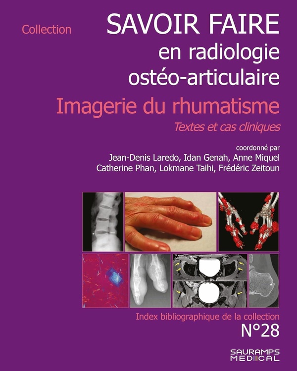 SAVOIR-FAIRE EN RADIOLOGIE OSTEO-ARTICULAIRE N 28 - IMAGERIE DU RHUMATISME