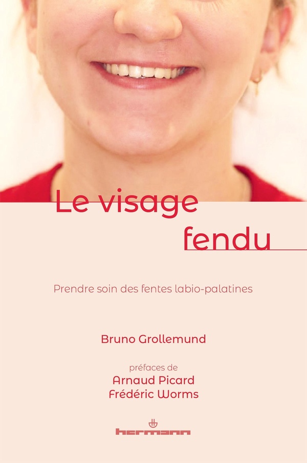 LE VISAGE FENDU - PRENDRE SOIN DES FENTES LABIO-PALATINES