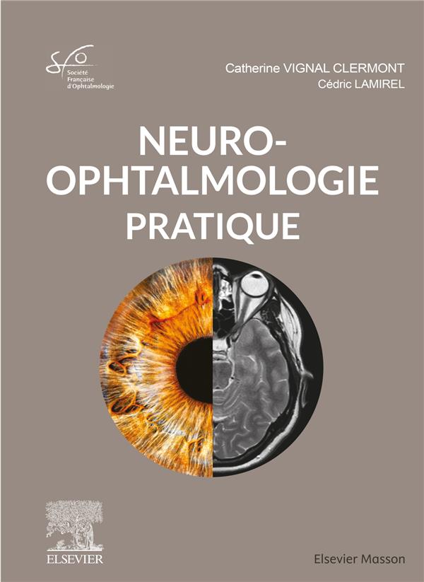 NEURO-OPHTALMOLOGIE PRATIQUE - RAPPORT SFO 2020