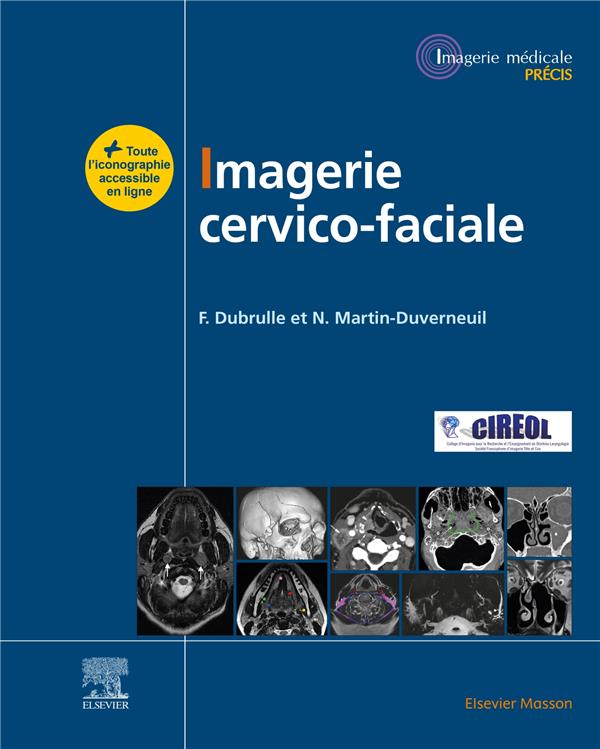 IMAGERIE CERVICOFACIALE - MASSIF FACIAL  SINUS  VOIES AERODIGESTIVES SUPERIEURES - PATHOLOGIES CER