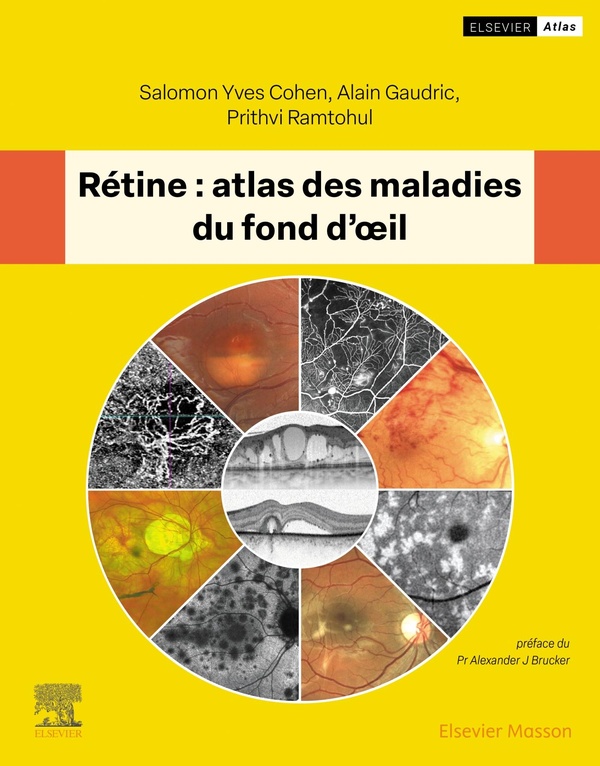 RETINE : ATLAS DES MALADIES DU FOND D'OEIL
