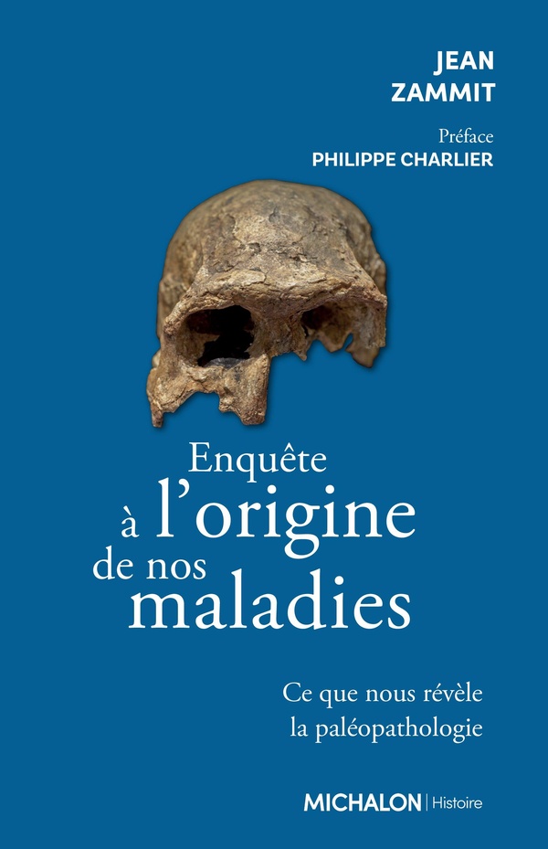 ENQUETE A L'ORIGINE DE NOS MALADIES - CE QUE NOUS REVELE LA PALEOPATHOLOGIE