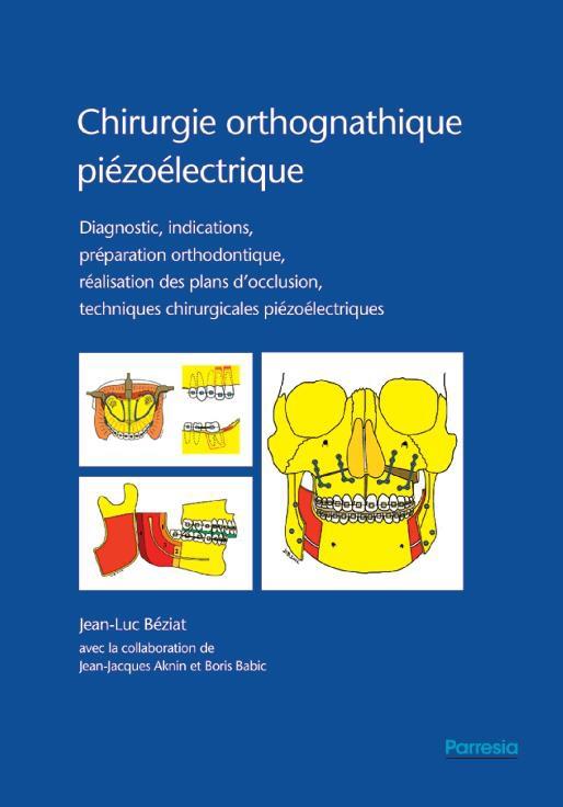 CHIRURGIE ORTHOGNATHIQUE PIEZOELECTRIQUE - NOUVELLE EDITION - DIAGNOSTIC, INDICATIONS, PREPARATION O
