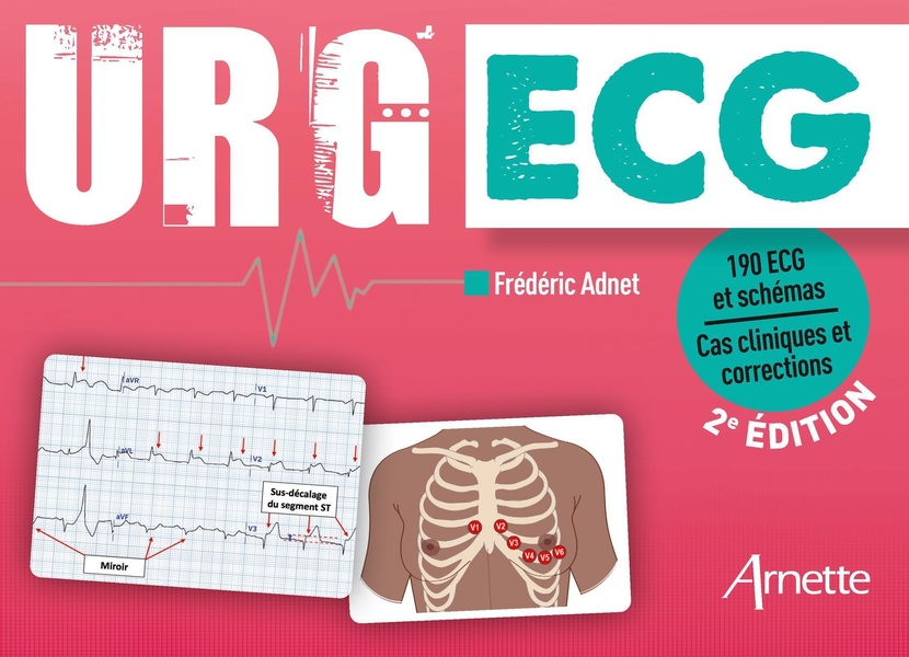 URG' ECG (2E EDITION) - 210 ECG ET SCHEMAS - CAS CLINIQUES ET CORRECTIONS