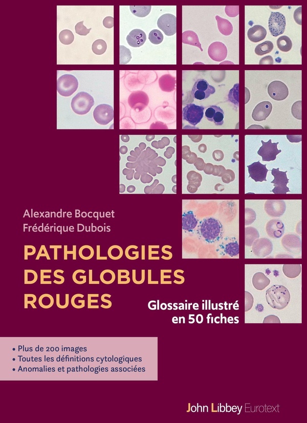 PATHOLOGIES DES GLOBULES ROUGES - GLOSSAIRE ILLUSTRE EN 50 FICHES