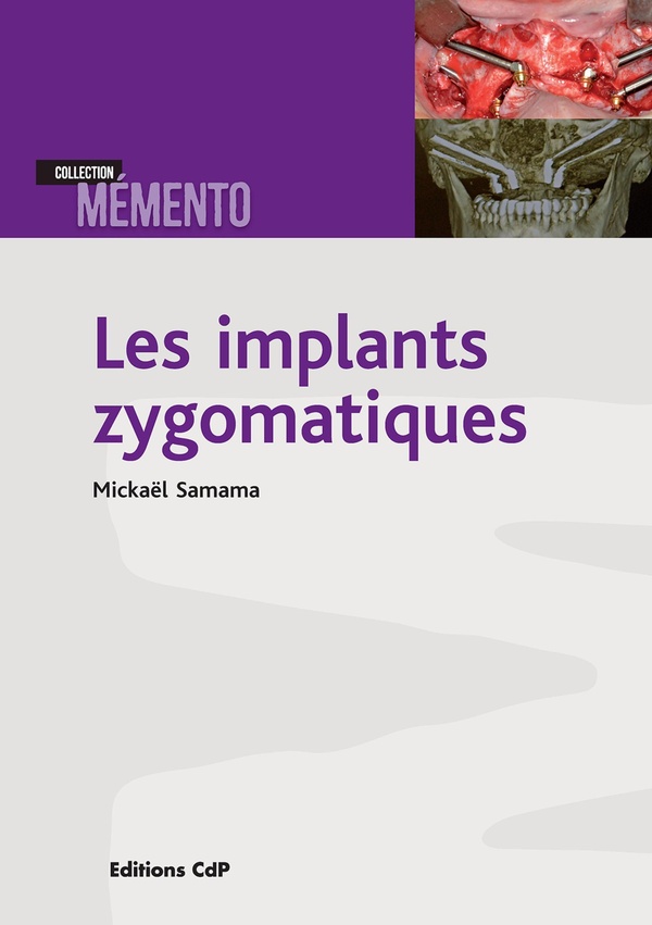 LES IMPLANTS ZYGOMATIQUES