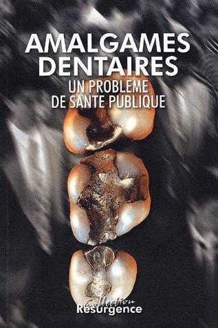 AMALGAMES DENTAIRES