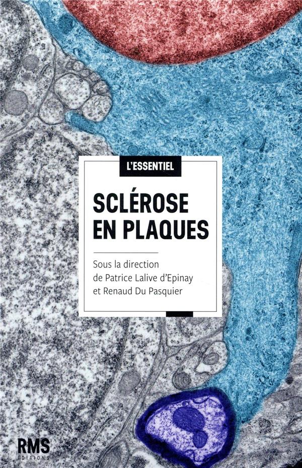 SCLEROSE EN PLAQUES