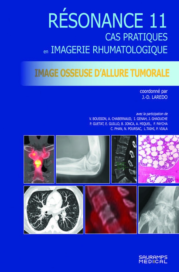 RESONANCE 11 - IMAGERIE OSSEUSE D'ALLURE TUMORALE - CAS PRATIQUES EN IMAGERIE MUSCULOSQUELETTIQUE