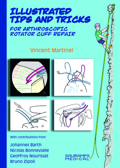 ILLUSTRATED TIPS & TRICKS FOR ARTHROSCOPIC ROTATOR CUFF REPAIR