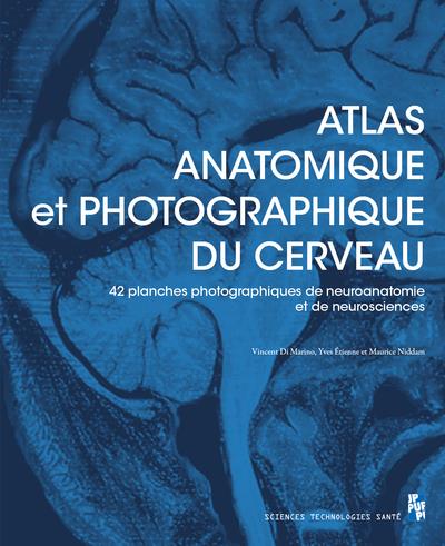 ATLAS ANATOMIQUE ET PHOTOGRAPHIQUE DU CERVEAU - 42 PLANCHES (DONT 41 PHOTOGRAPHIQUES) DE NEUROANATOM
