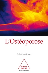 L'OSTEOPOROSE